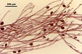 6 - Dettaglio delle tetrasporocisti